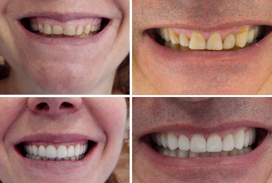 Sonrisa COED